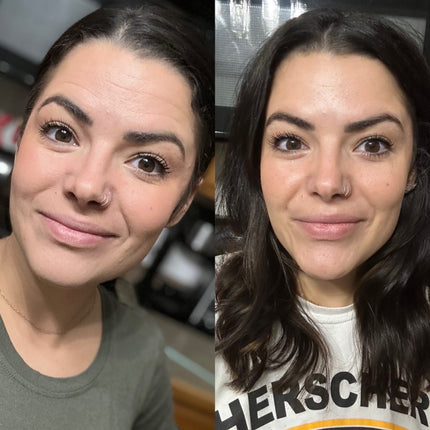 split image of woman's face Before and after frownies wrinkle patches to smooth forehead lines