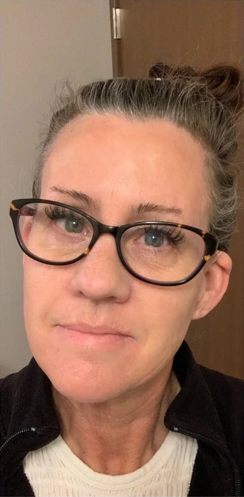 woman with mature skin and smooth skin after using frownies facial patches