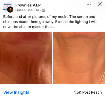 facebook_testimonial_for_neck_mask_results