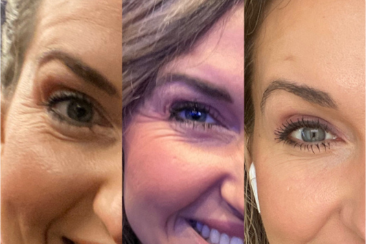 Eye Serums vs Eye Creams: The Secret to Refreshed Under Eyes!