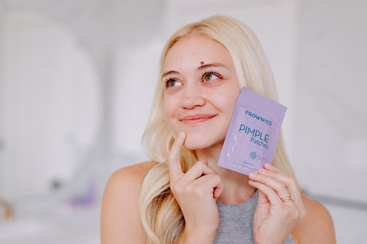 Navigating Acne-Friendly Products for Clearer Skin