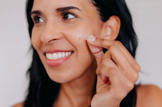 Understanding the Causes of Acne and Empowering Your Skin's Health