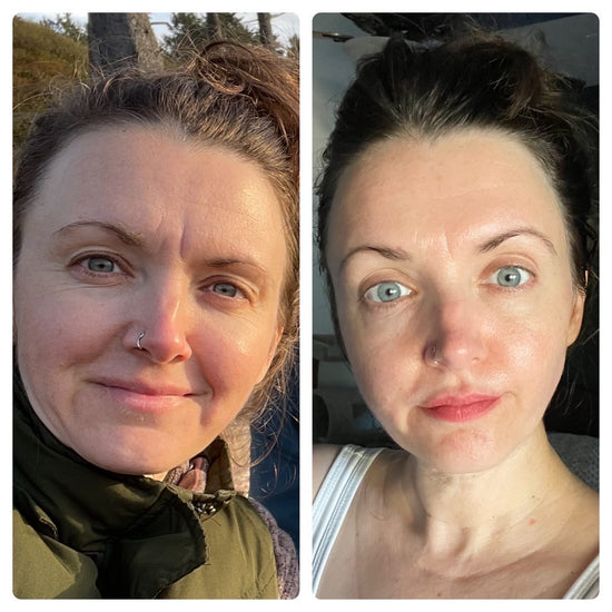 split image of brunette woman with deep 11 lines on the left and after image on right with softened 11 lines after using frownies facial patches