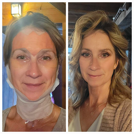 before and after of frownies chin up, side by side image of blonde woman, left side wearing frownies facial patches, frownies under eye gels, and frownies chin-up mask over jawline and neck, after image on the right with woman with her hair and makeup done