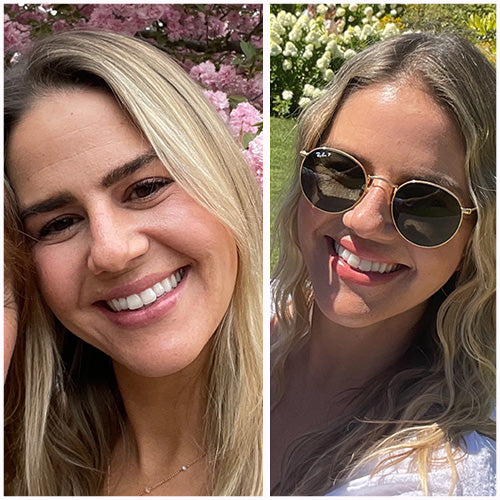 split image of blonde woman with before photo on the left showing natural skin and after photo on the right showing how wearing frownies facial patches smooth forehead wrinkles