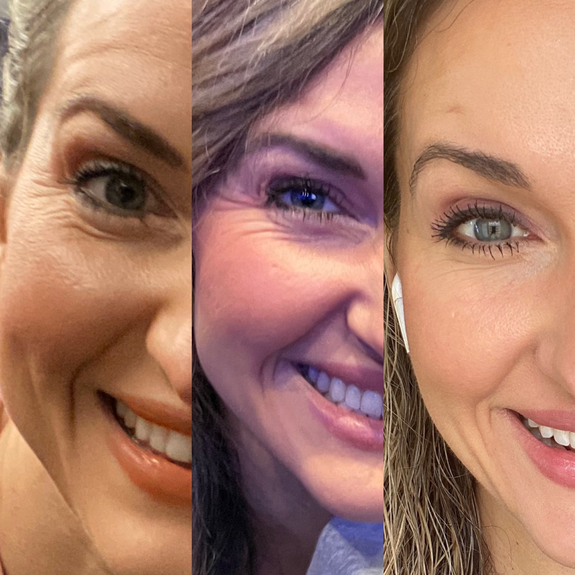 3 iimages of a woman corner of eyes showing before and after use of Frownies Apple Serum 